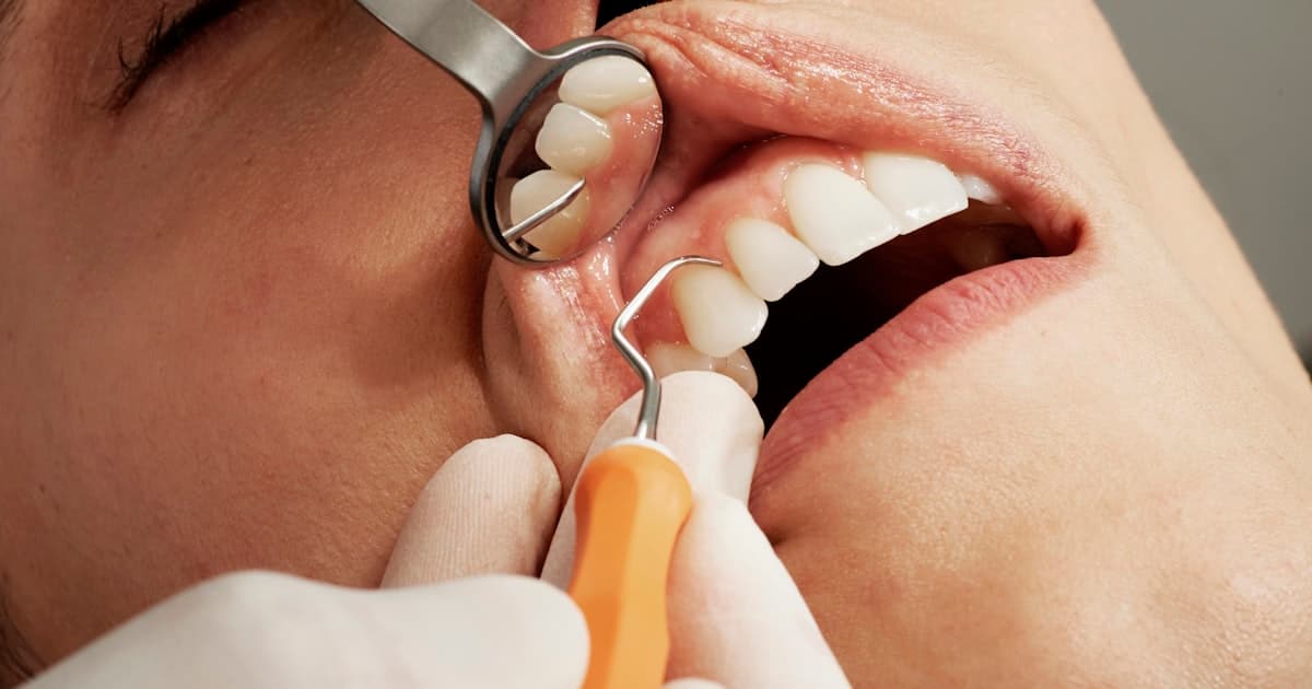Dentist performing root canal treatment at Dent Health Dental Clinic, Banjara Hills, Hyderabad