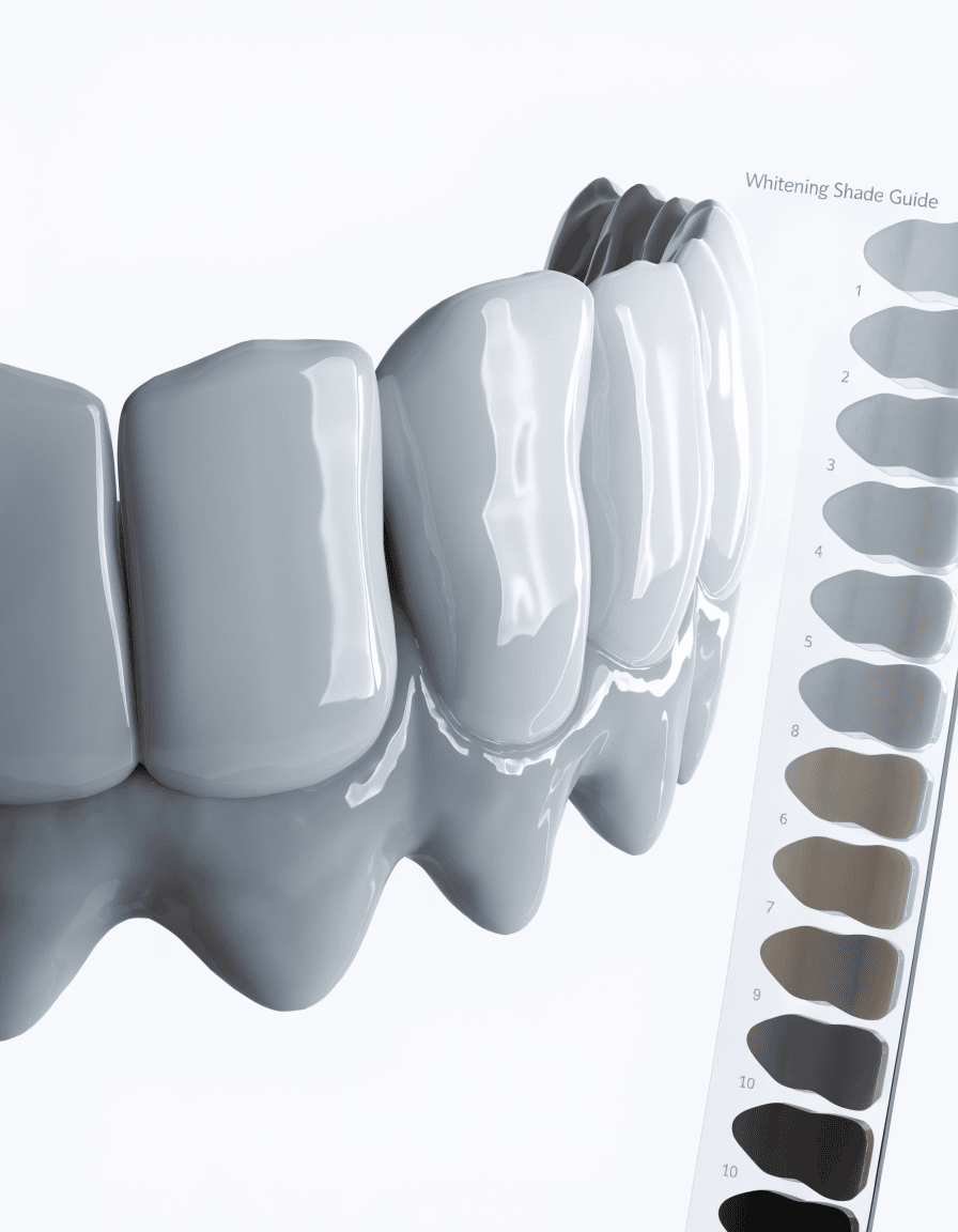 Teeth Whitening in Banjara Hills, Hyderabad - Dent Health