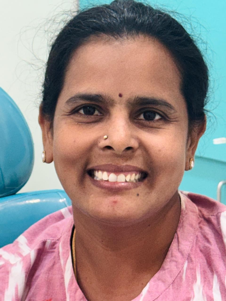 After - dental filling at Dent Health, Banjara Hills, Hyderabad After - dental filling at Dent Health, Banjara Hills, Hyderabad